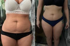 Aakformalas-eredmeny-12-Premium-Infrashape-studio-jpg