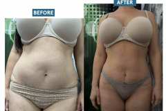 Cryo-mastersculpt-infrashape-alakformalas-2