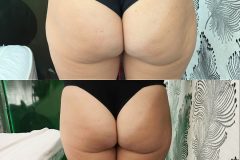 Infrashape-EMS-elotte-utana-2