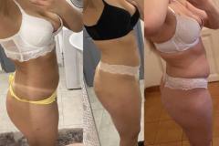 Infrashape-Nem-tudom-milyen-kezeles-vendeg-kuldte