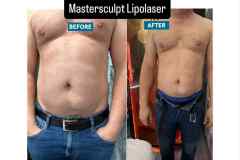 Infrashape-mastersculpt-elotte-utana-2