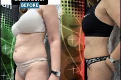 Mastersculpt-Infrashape-alakformalas-elotte-utana-5-2026-0416