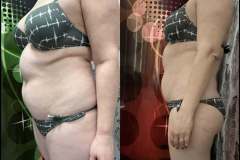 Mastersculpt-Infrashape-alakformalas-elotte-utana-6-2026-0416