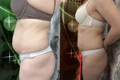 Mastersculpt-alakformalas-elotte-utana-6-2026-0423