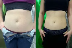 infrashape-4-monosculpt-infrashape-kezeles-eredmeny-15