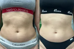 infrashape-web-25-mastersculpt-es-infrashape-alakformalas-eredmeny-3-het