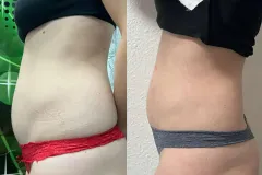 infrashape-web-27-monoshape-4-alkalom-alakformalas-eredmeny