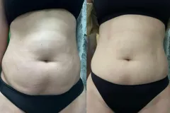 infrashape-web-28-mastersculpt-es-infrashape-alakformalas-eredmeny-3-het