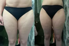 infrashape-web-29-mastersculptinfrashape-3-het