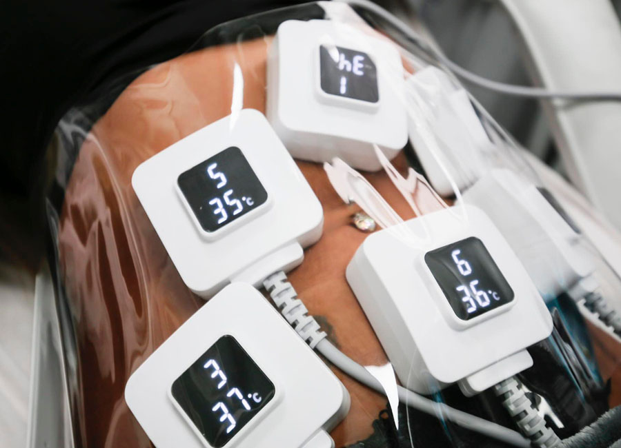 Monosculpt alakformálás Angyalföld Prémium INfrashape Stúdió 900x650